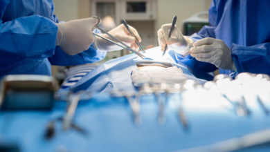 Pilonidal Disease: DNA or Daily Routine?